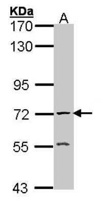 Western Blot: Acetylcholinesterase/ACHE Antibody [NBP1-31329]