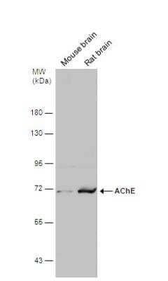 Western Blot: Acetylcholinesterase/ACHE Antibody [NBP1-31329]