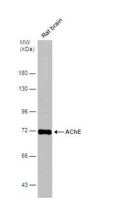 Western Blot: Acetylcholinesterase/ACHE Antibody [NBP1-31329]