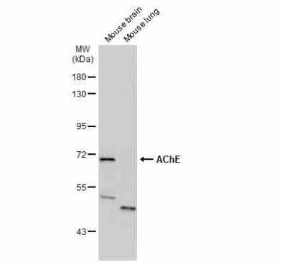 Western Blot: Acetylcholinesterase/ACHE Antibody [NBP1-31329]