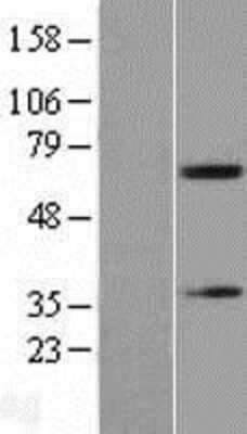 Western Blot: Acetylcholinesterase/ACHE Overexpression Lysate [NBL1-07238]