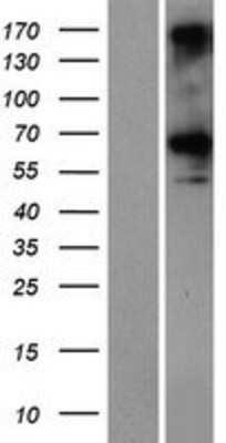 Western Blot: Acetylcholinesterase/ACHE Overexpression Lysate [NBP2-10697]