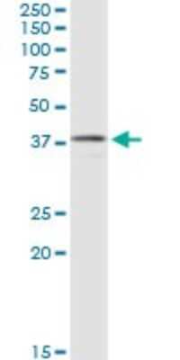 Western Blot: Acidic Calponin Antibody (2C7) [H00001266-M03]