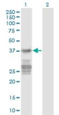 Western Blot: Acidic Calponin Antibody (2C7) [H00001266-M03]