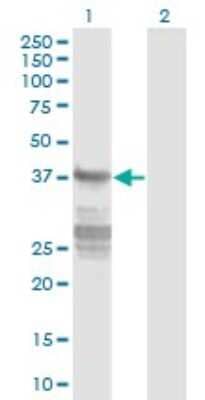 Western Blot: Acidic Calponin Antibody (4C4) [H00001266-M01]