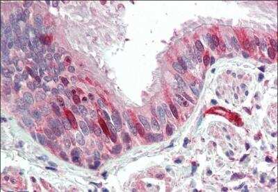 Immunohistochemistry-Paraffin: Acidic Calponin Antibody [NBP1-51972]