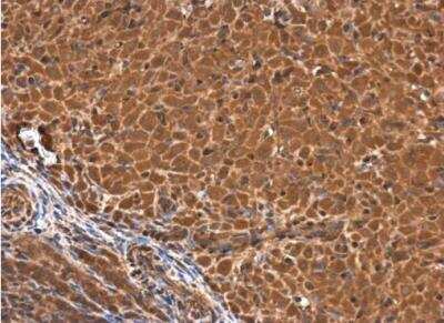 Immunohistochemistry-Paraffin: Acidic Calponin Antibody [NBP2-15242]