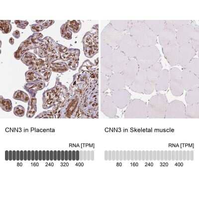 Immunohistochemistry-Paraffin: Acidic Calponin Antibody [NBP2-38643]