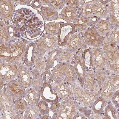 Immunohistochemistry-Paraffin: Acidic Calponin Antibody [NBP2-38643]