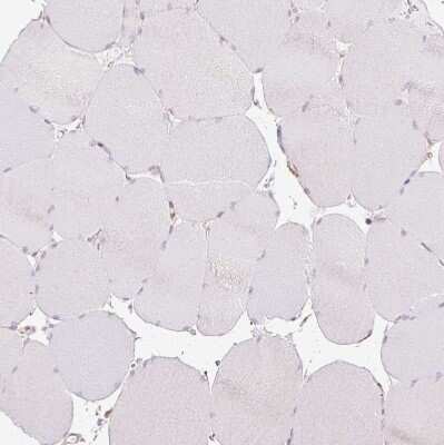 Immunohistochemistry-Paraffin: Acidic Calponin Antibody [NBP2-38643]