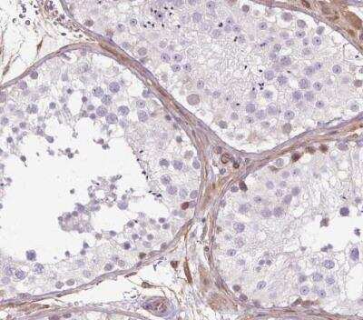 Immunohistochemistry-Paraffin: Acidic Calponin Antibody [NBP2-38643]