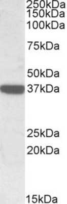 Western Blot: Acidic Calponin Antibody [NBP1-51972]