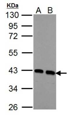 Western Blot: Acidic Calponin Antibody [NBP2-15242]