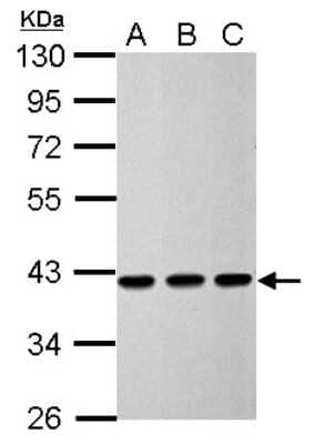 Western Blot: Acidic Calponin Antibody [NBP2-15242]