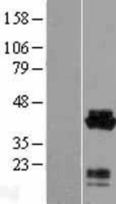 Western Blot: Acidic Calponin Overexpression Lysate [NBL1-09315]