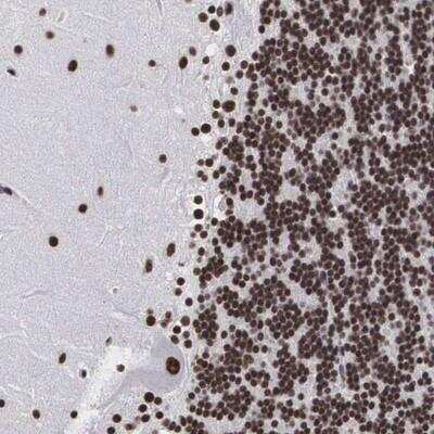 Immunohistochemistry-Paraffin: Acinus Antibody [NBP1-90823]