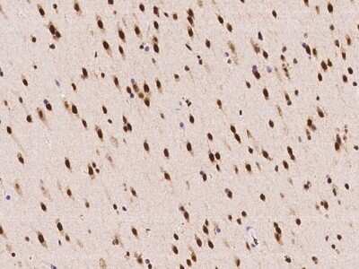 Immunohistochemistry-Paraffin: Acinus Antibody [NBP2-98082]