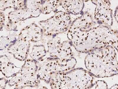 Immunohistochemistry-Paraffin: Acinus Antibody [NBP2-98082]