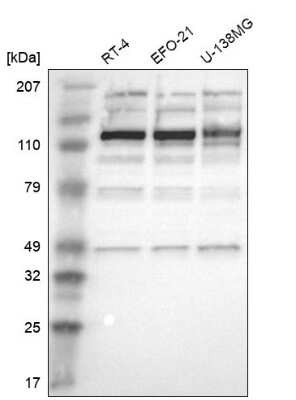 Western Blot: Acinus Antibody [NBP1-90823]