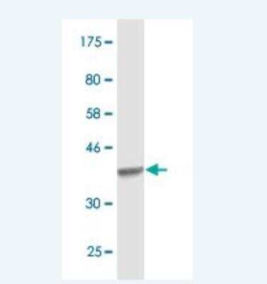 Western Blot: Aconitase 1 Antibody (2F6) [H00000048-M02]