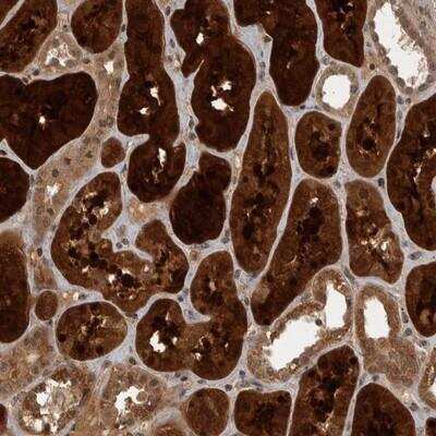 Immunohistochemistry: Aconitase 1 Antibody [NBP1-87678]