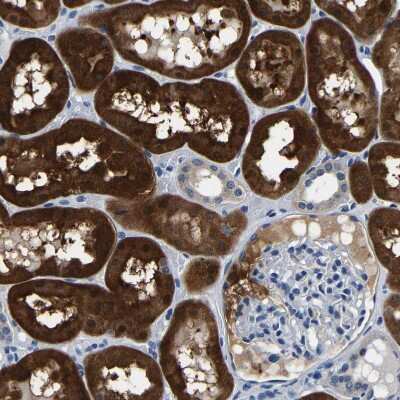 Immunohistochemistry-Paraffin: Aconitase 1 Antibody [NBP1-87677]