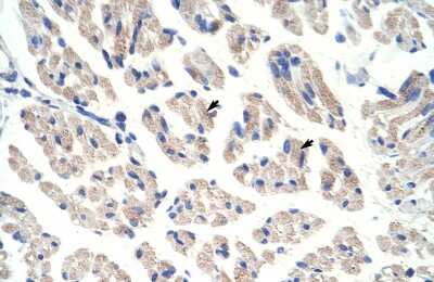 Immunohistochemistry-Paraffin: Aconitase 1 Antibody [NBP3-10536]