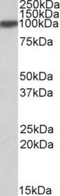 Western Blot: Aconitase 1 Antibody [NBP1-51965]