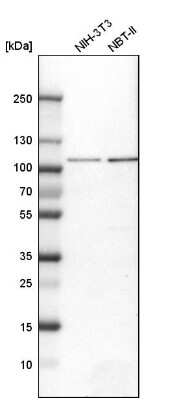 Western Blot: Aconitase 1 Antibody [NBP1-87677]