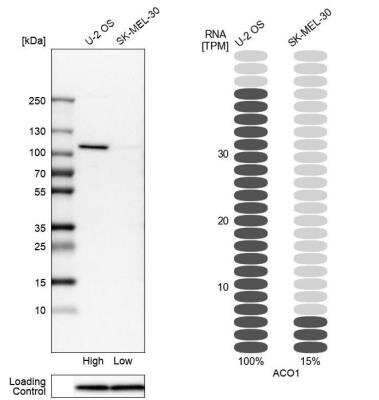 Western Blot: Aconitase 1 Antibody [NBP1-87677]