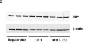Western Blot: Aconitase 1 Antibody [NBP1-87677]