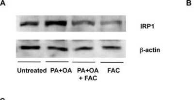 Western Blot: Aconitase 1 Antibody [NBP1-87677]