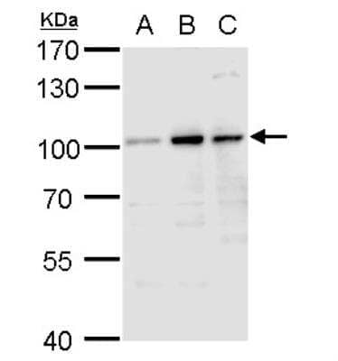 Western Blot: Aconitase 1 Antibody [NBP2-15244]