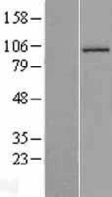 Western Blot: Aconitase 1 Overexpression Lysate [NBL1-07243]