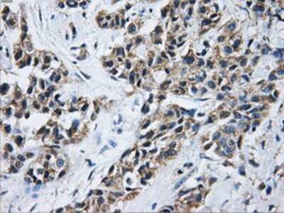 Immunohistochemistry-Paraffin: Aconitase 2 Antibody (OTI3G8) [NBP2-02241]
