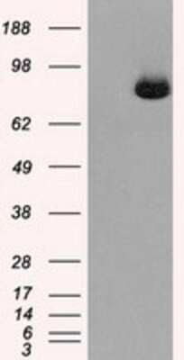 Western Blot: Aconitase 2 Antibody (OTI3G8) [NBP2-02241]