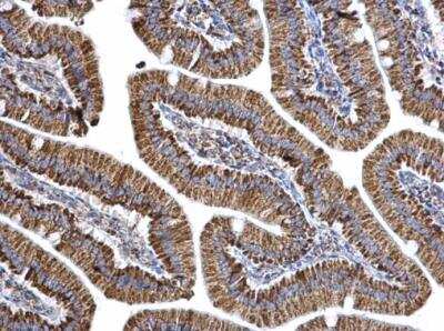 Immunohistochemistry-Paraffin: Aconitase 2 Antibody [NBP1-32781]