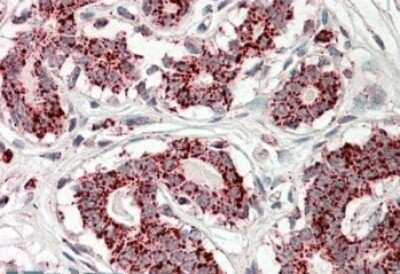 Immunohistochemistry-Paraffin: Aconitase 2 Antibody [NBP1-52014]
