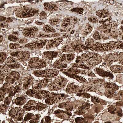 Immunohistochemistry-Paraffin: Aconitase 2 Antibody [NBP1-90264]