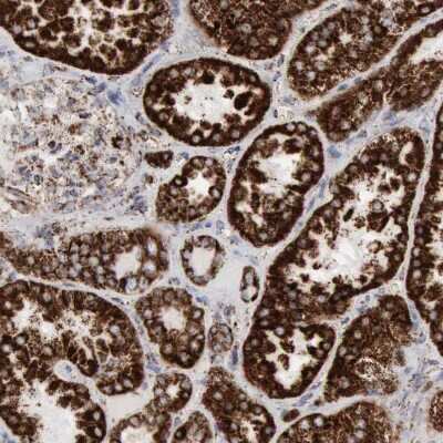 Immunohistochemistry-Paraffin: Aconitase 2 Antibody [NBP1-90264]