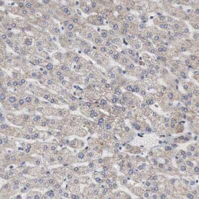 Immunohistochemistry-Paraffin: Aconitase 2 Antibody [NBP1-90264]