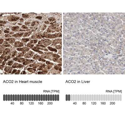 Immunohistochemistry-Paraffin: Aconitase 2 Antibody [NBP1-90264]