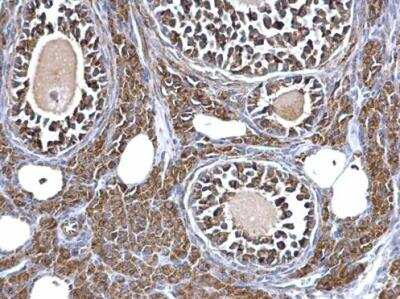 Immunohistochemistry-Paraffin: Aconitase 2 Antibody [NBP2-15245]