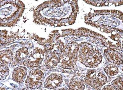 Immunohistochemistry-Paraffin: Aconitase 2 Antibody [NBP2-15245]