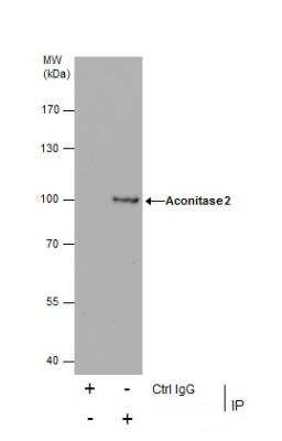 Immunoprecipitation: Aconitase 2 Antibody [NBP2-15245]