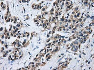 Immunohistochemistry: Aconitase 2 Antibody (OTI3G8) - Azide and BSA Free [NBP2-70074]