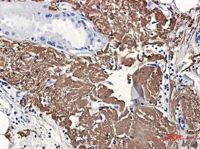 Immunohistochemistry-Paraffin: Aconitase 2 Antibody (S07-7A1) [NBP3-19829]
