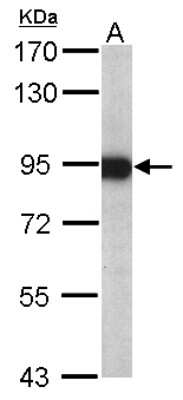 Western Blot: Aconitase 2 Antibody [NBP1-32781]