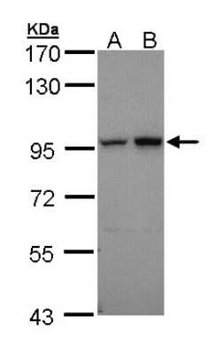 Western Blot: Aconitase 2 Antibody [NBP1-32781]