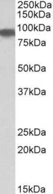 Western Blot: Aconitase 2 Antibody [NBP1-52014]